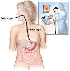 Endoskopi